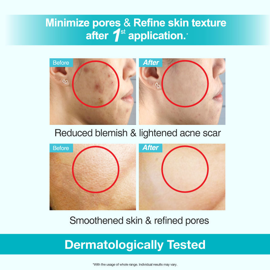 Purifying Serum 20ml (Exp: June 2026)