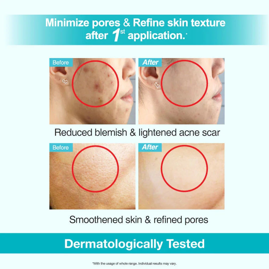 Blemish Clear 15ml (Exp: Dec 2026)